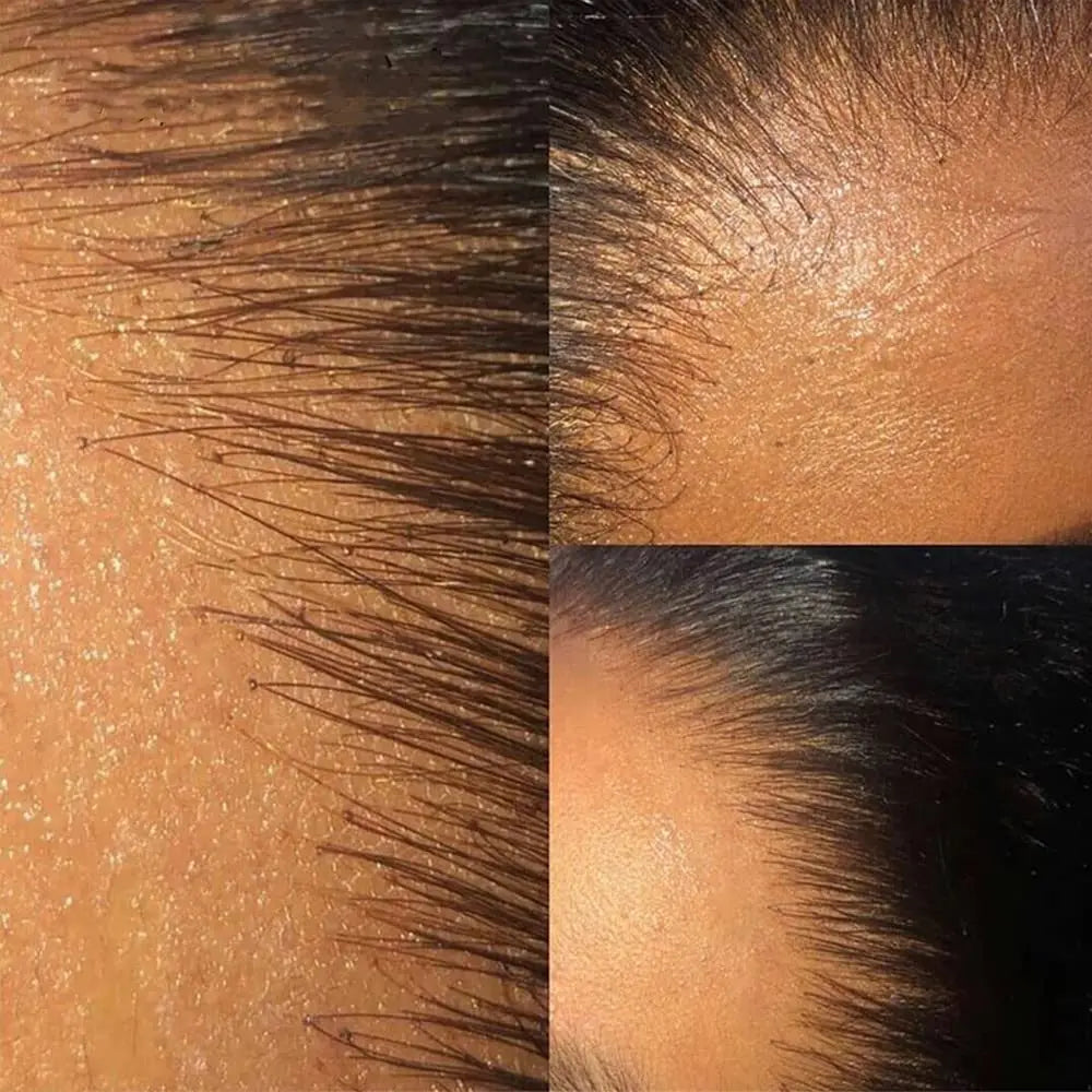 Straight Human Hair Lace Closure